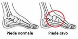 Hollow Foot Correction Insoles - Men's and Women's Shoes